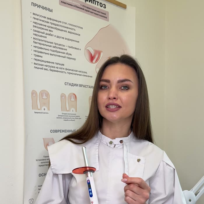 Разбор стадий онихокриптоза у наглядного плаката